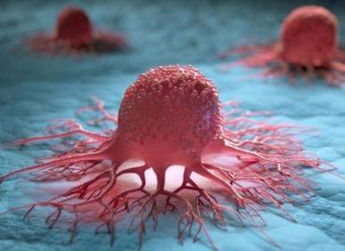 Nguồn nước &ocirc; nhiễm l&agrave; nguy&ecirc;n nh&acirc;n h&agrave;ng đầu g&acirc;y ung thư