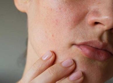 B&iacute; quyết uống nước hạn chế l&atilde;o h&oacute;a da cho phụ nữ từ 25t